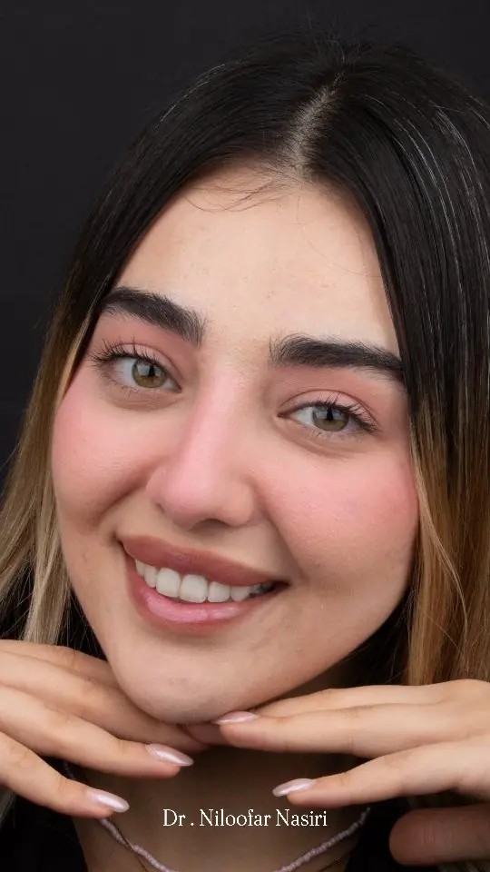 نمونه لبخند طراحی‌شده توسط دکتر نیلوفر نصیری